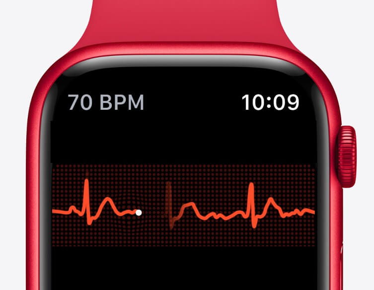 未来Apple Watch可能带来心血管监测功能